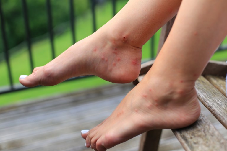 Sandflies New Zealand